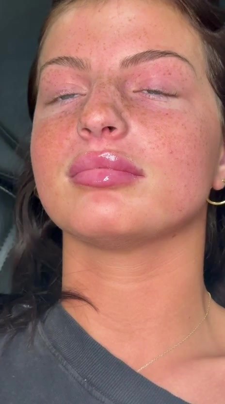 Nova Med Spa luxury treatment
